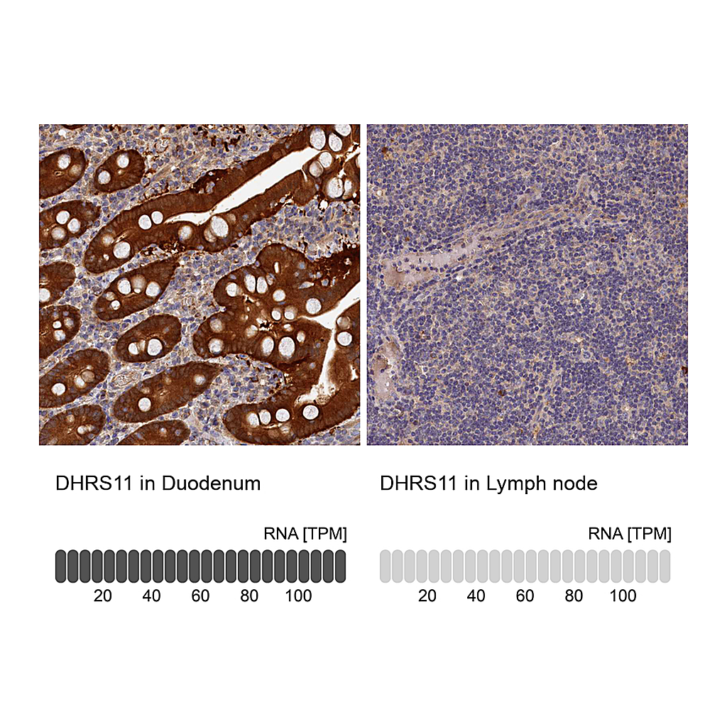 Atlas Antibodies Anti-DHRS11 Antibody