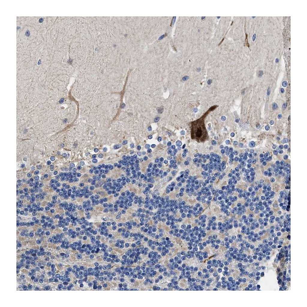 Atlas Antibodies Anti-DHRS13 Antibody