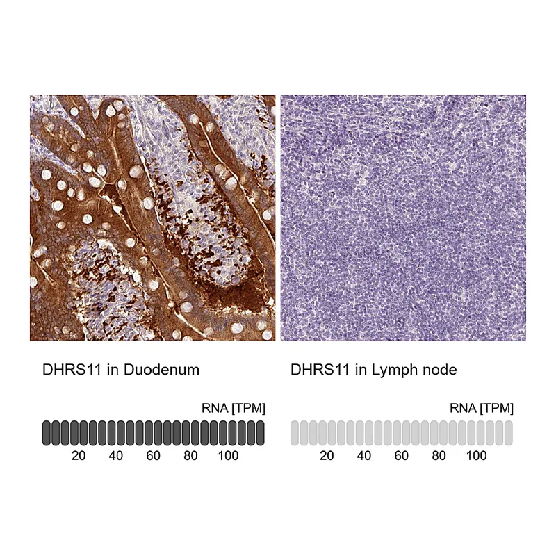 Atlas Antibodies Anti-DHRS11 Antibody