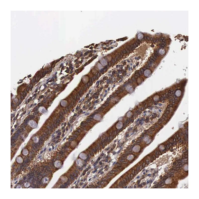 Atlas Antibodies Anti-DHRS1 Antibody
