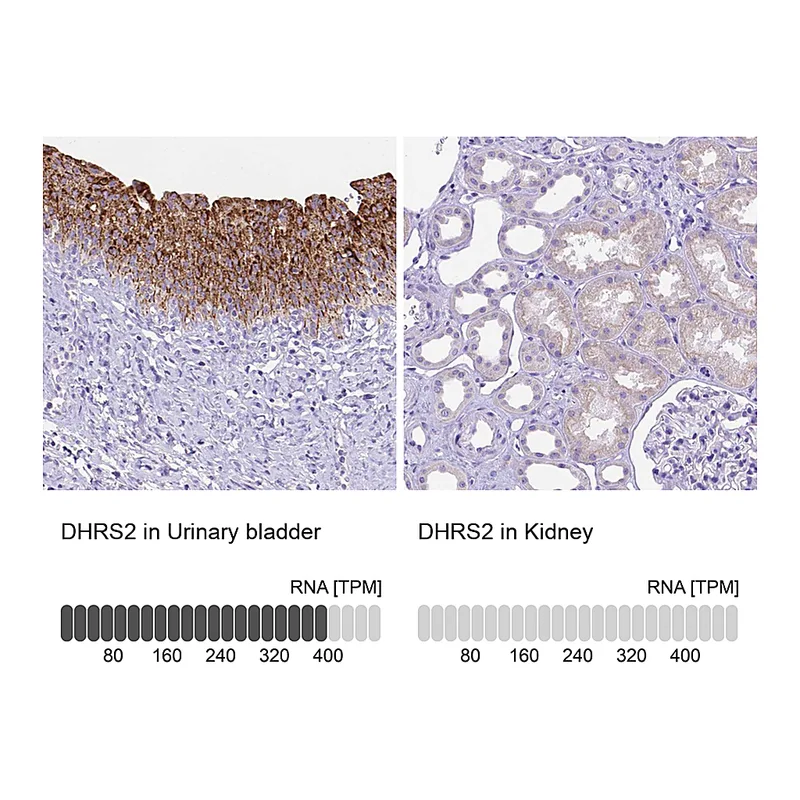 Atlas Antibodies Anti-DHRS2 Antibody