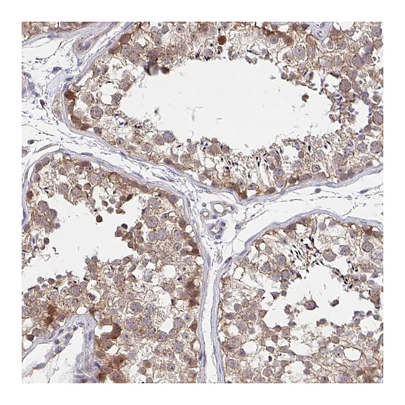 Atlas Antibodies Anti-DHRS12 Antibody