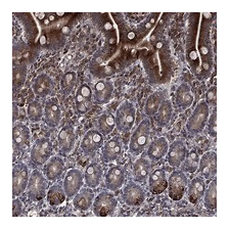 Atlas Antibodies Anti-DHRS7 Antibody