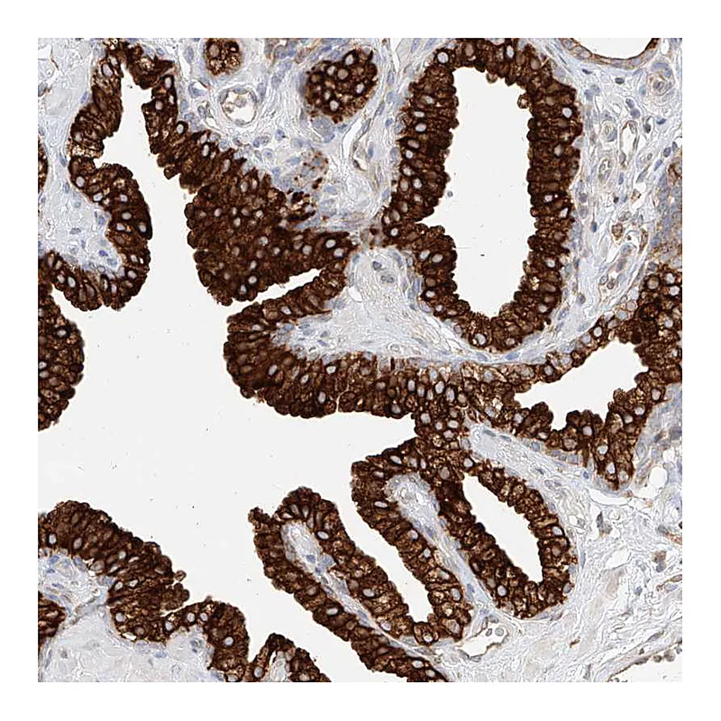 Atlas Antibodies Anti-DHRS7 Antibody