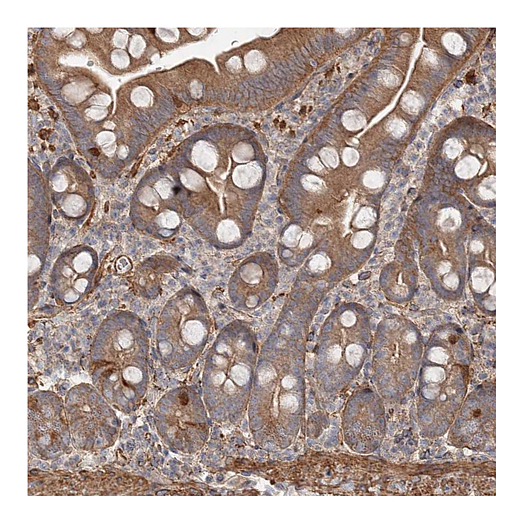 Atlas Antibodies Anti-DHRS9 Antibody