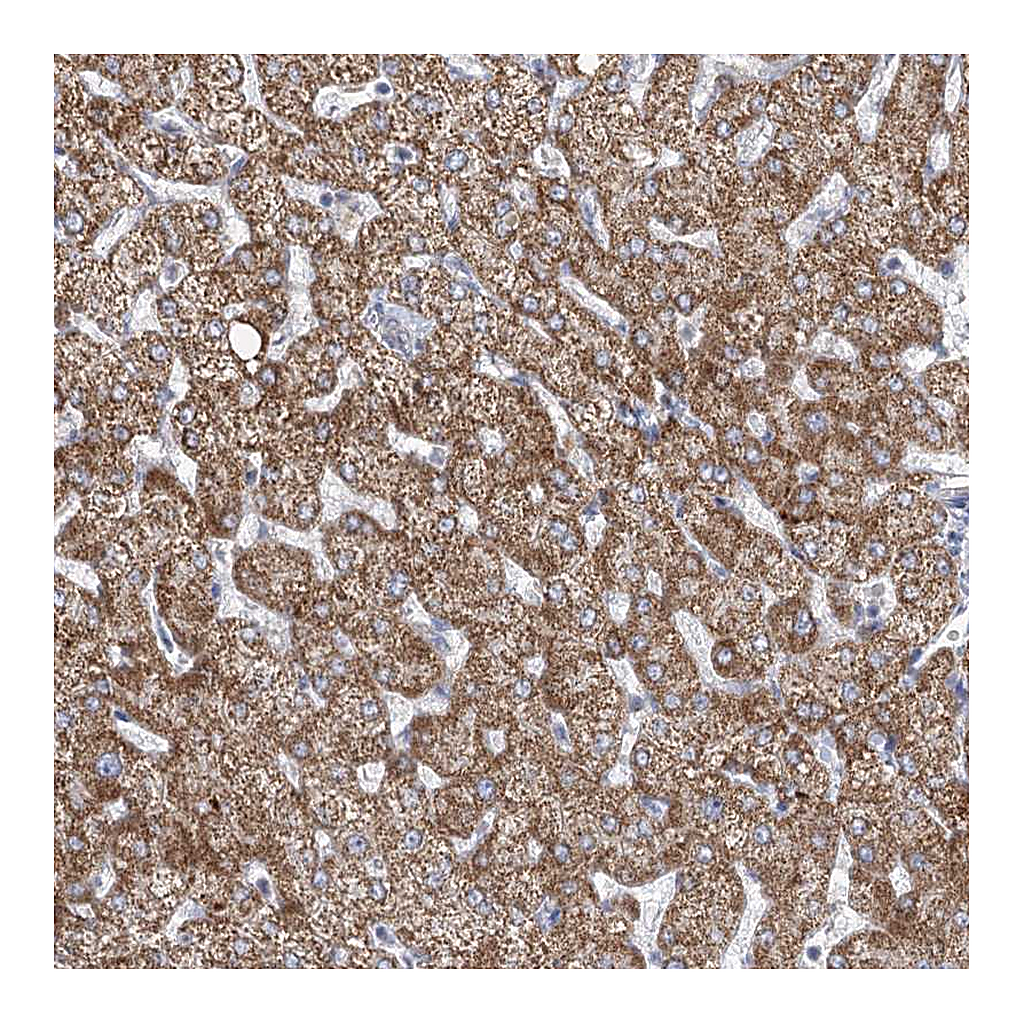 Atlas Antibodies Anti-DHTKD1 Antibody