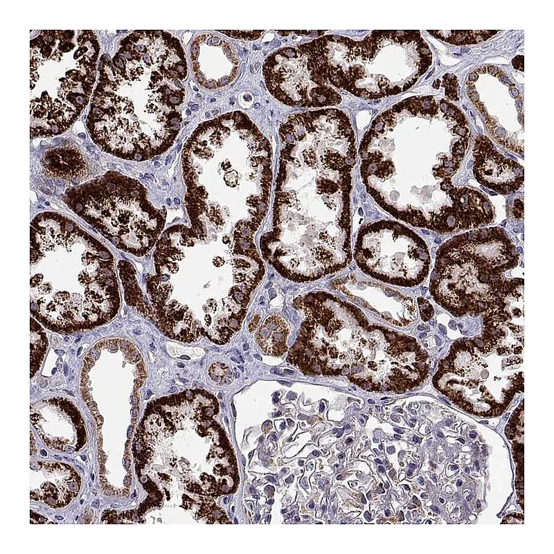 Atlas Antibodies Anti-DHTKD1 Antibody