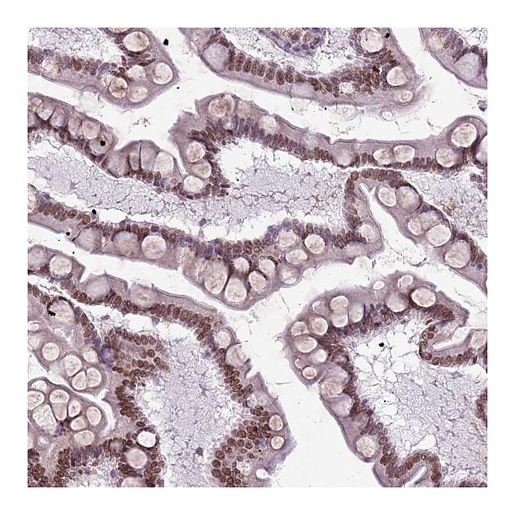 Atlas Antibodies Anti-DHX32 Antibody