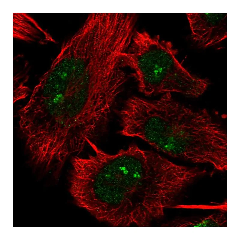 Atlas Antibodies Anti-DHX33 Antibody