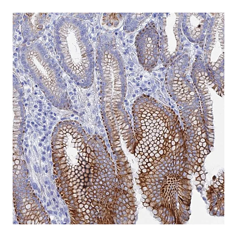Atlas Antibodies Anti-DHX34 Antibody