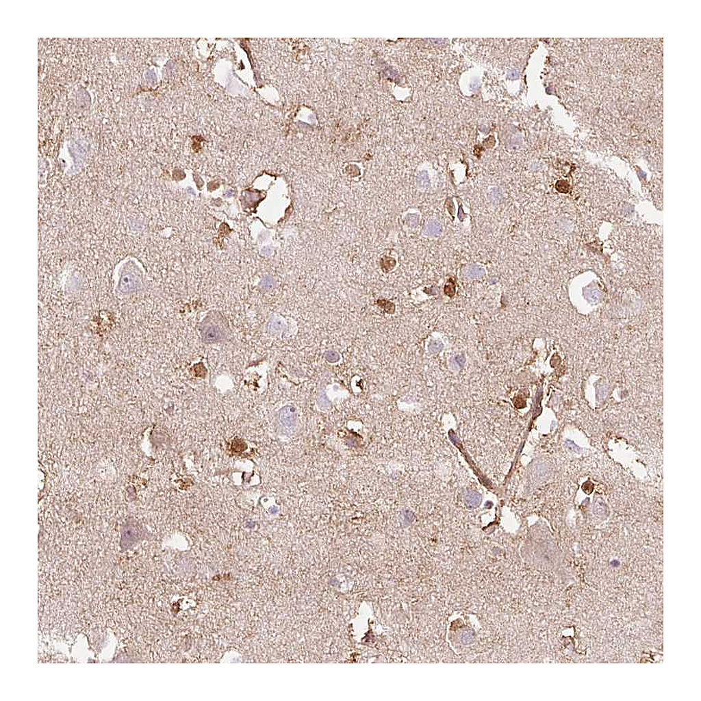 Atlas Antibodies Anti-DHX35 Antibody