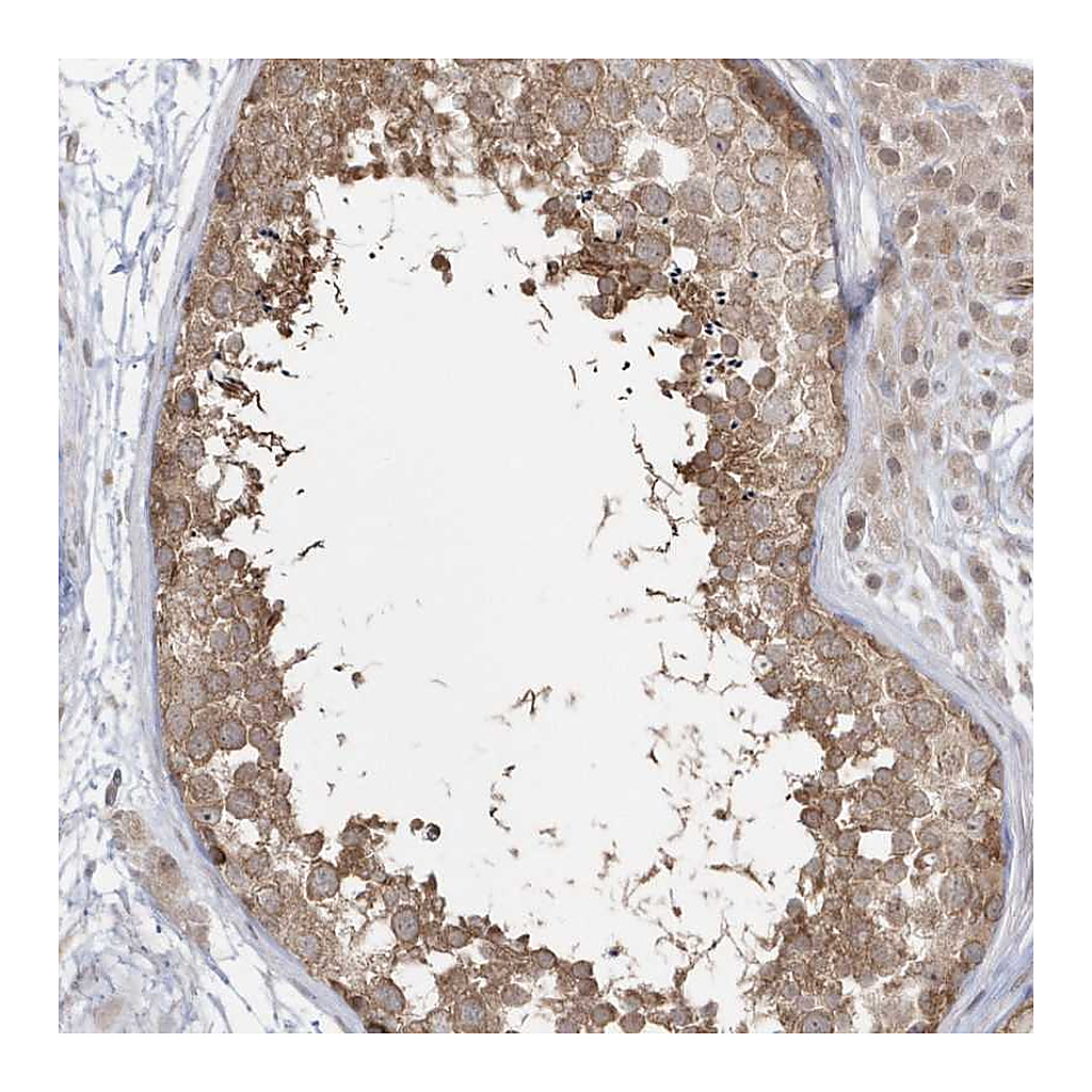 Atlas Antibodies Anti-DHX57 Antibody