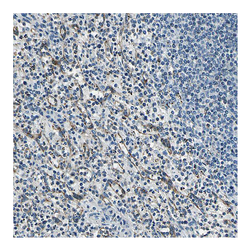 Atlas Antibodies Anti-DIAPH1 Antibody