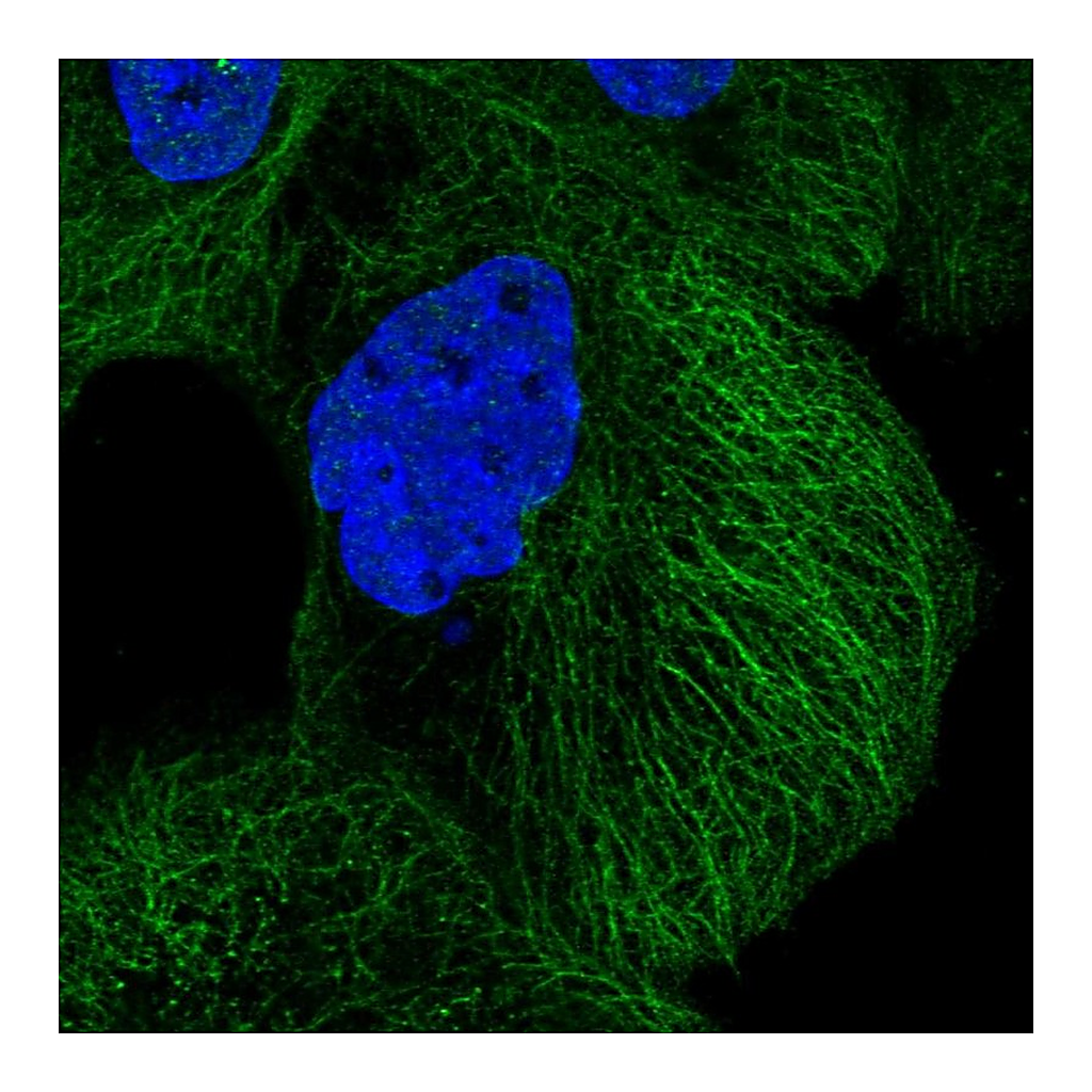 Atlas Antibodies Anti-DIAPH3 Antibody