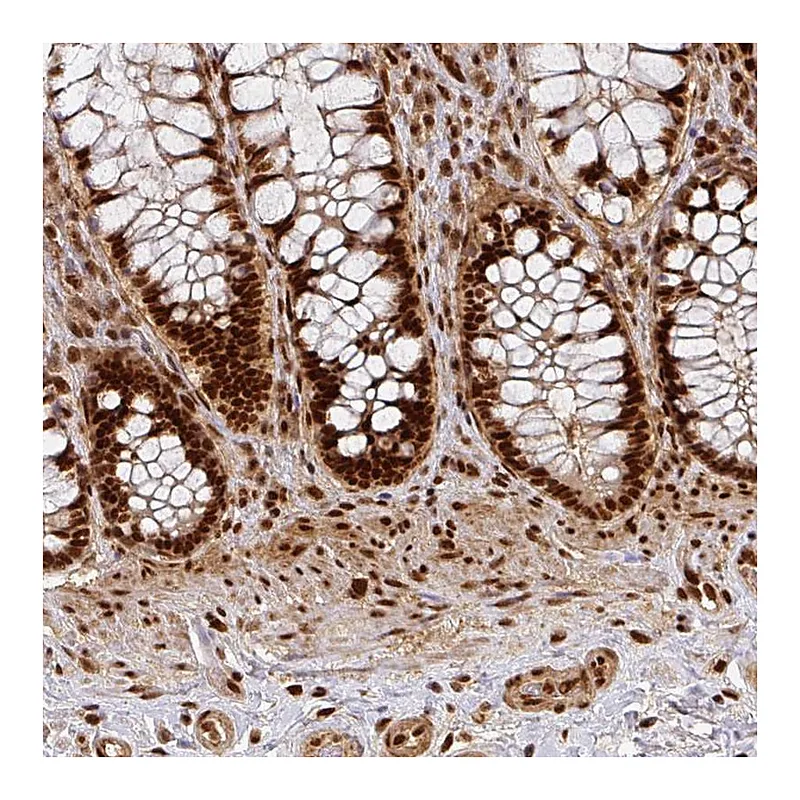 Atlas Antibodies Anti-DIDO1 Antibody