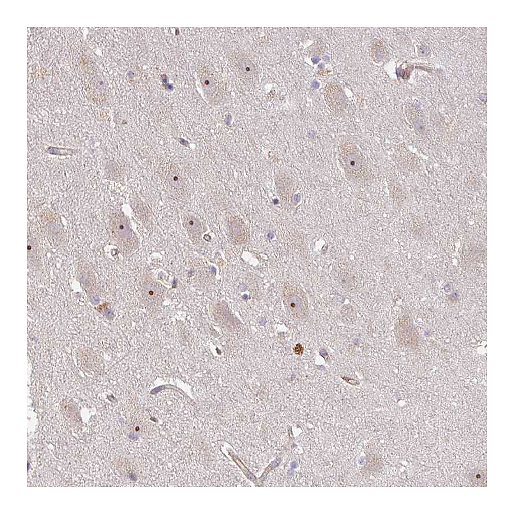 Atlas Antibodies Anti-DIMT1 Antibody