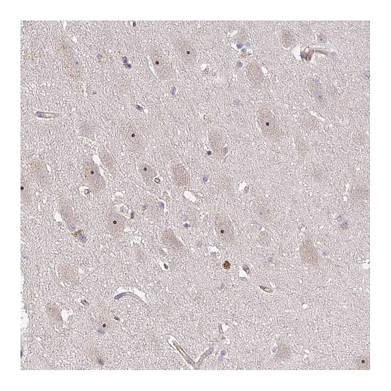 Atlas Antibodies Anti-DIMT1 Antibody