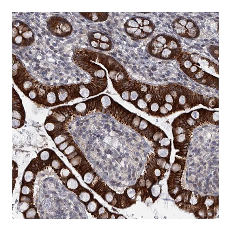 Atlas Antibodies Anti-DIEXF Antibody