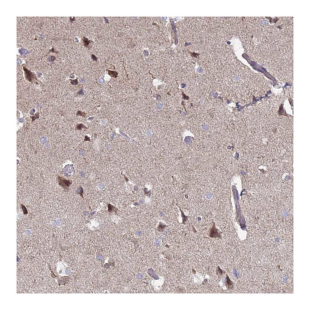 Atlas Antibodies Anti-DIP2B Antibody