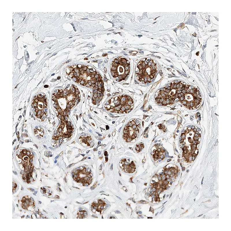 Atlas Antibodies Anti-DIRAS3 Antibody
