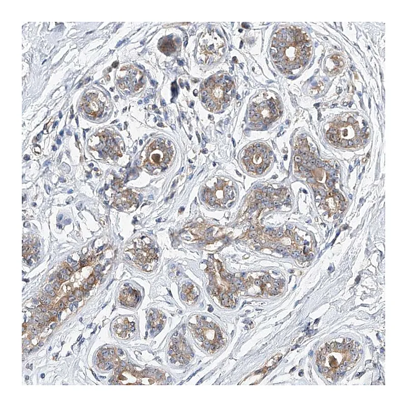 Atlas Antibodies Anti-DIRAS3 Antibody
