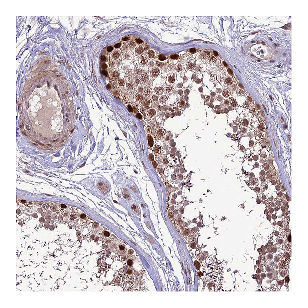 Atlas Antibodies Anti-DIS3 Antibody