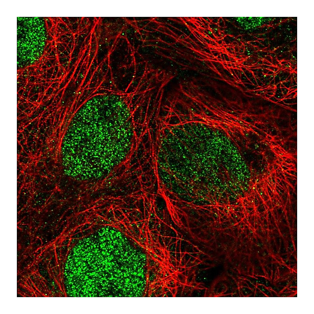 Atlas Antibodies Anti-DIS3 Antibody