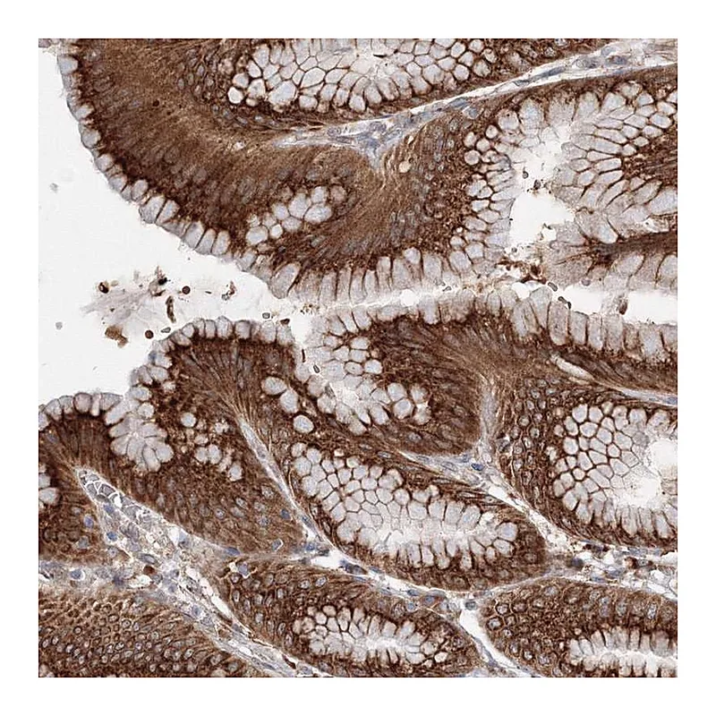 Atlas Antibodies Anti-DIS3L2 Antibody