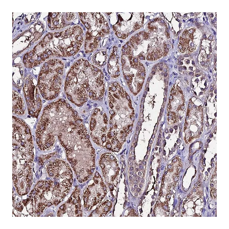 Atlas Antibodies Anti-DIS3L Antibody