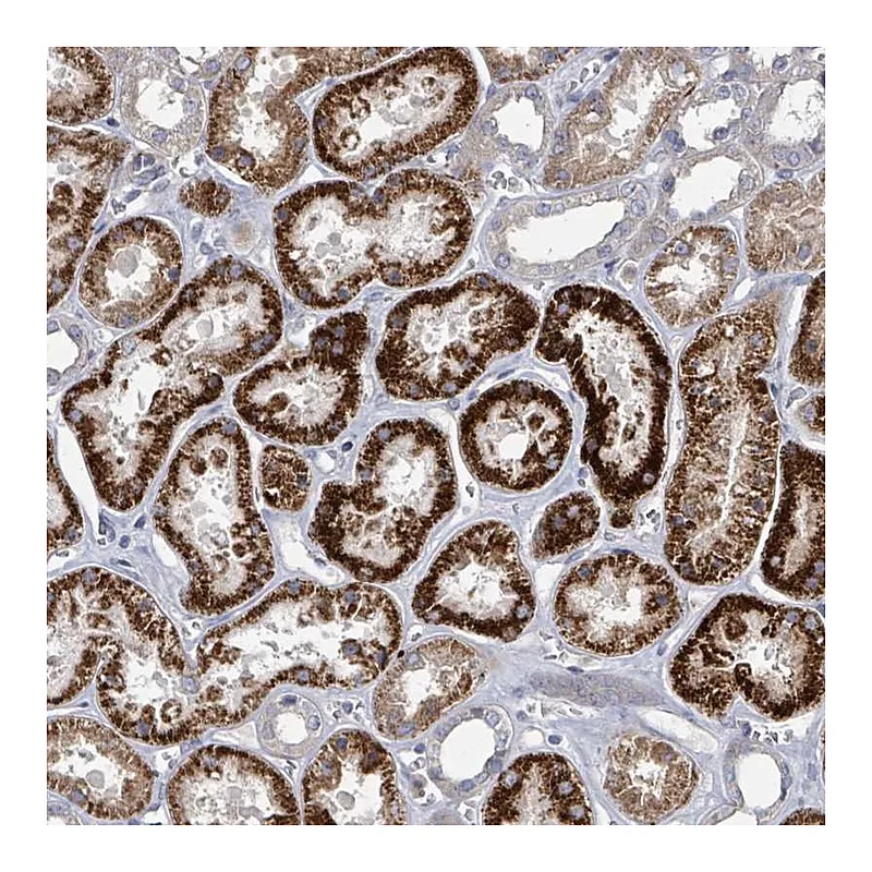 Atlas Antibodies Anti-DISP1 Antibody