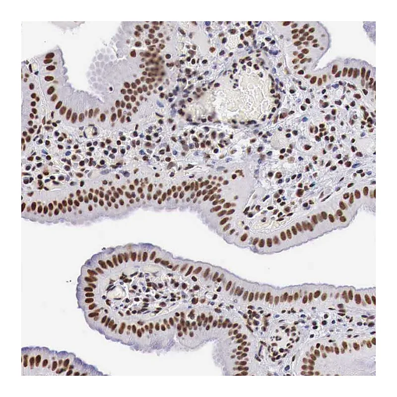Atlas Antibodies Anti-DKC1 Antibody