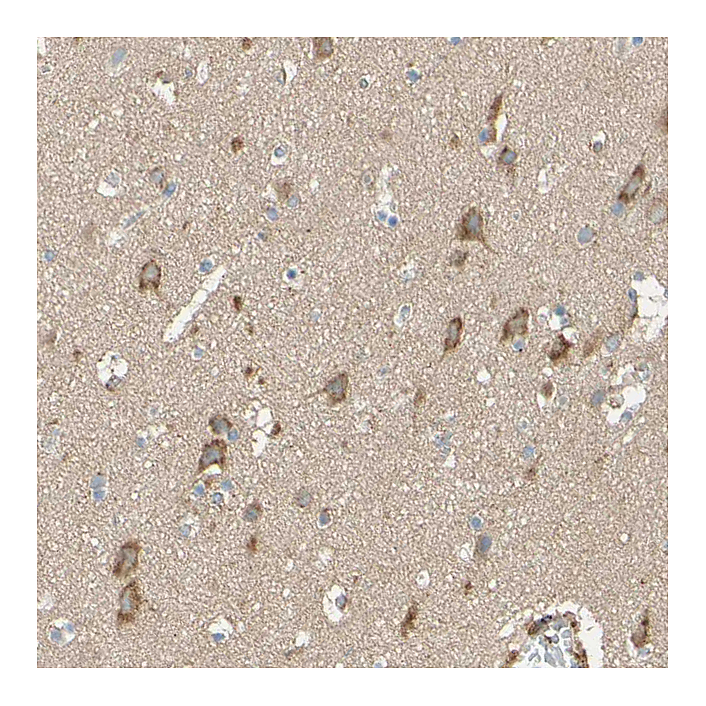 Atlas Antibodies Anti-DKK3 Antibody