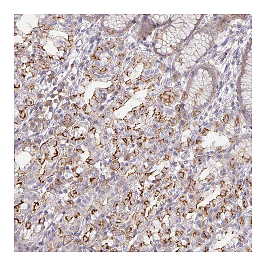 Atlas Antibodies Anti-DISP2 Antibody