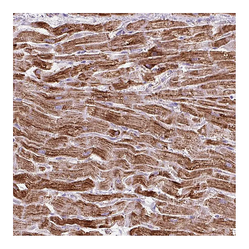 Atlas Antibodies Anti-DLAT Antibody