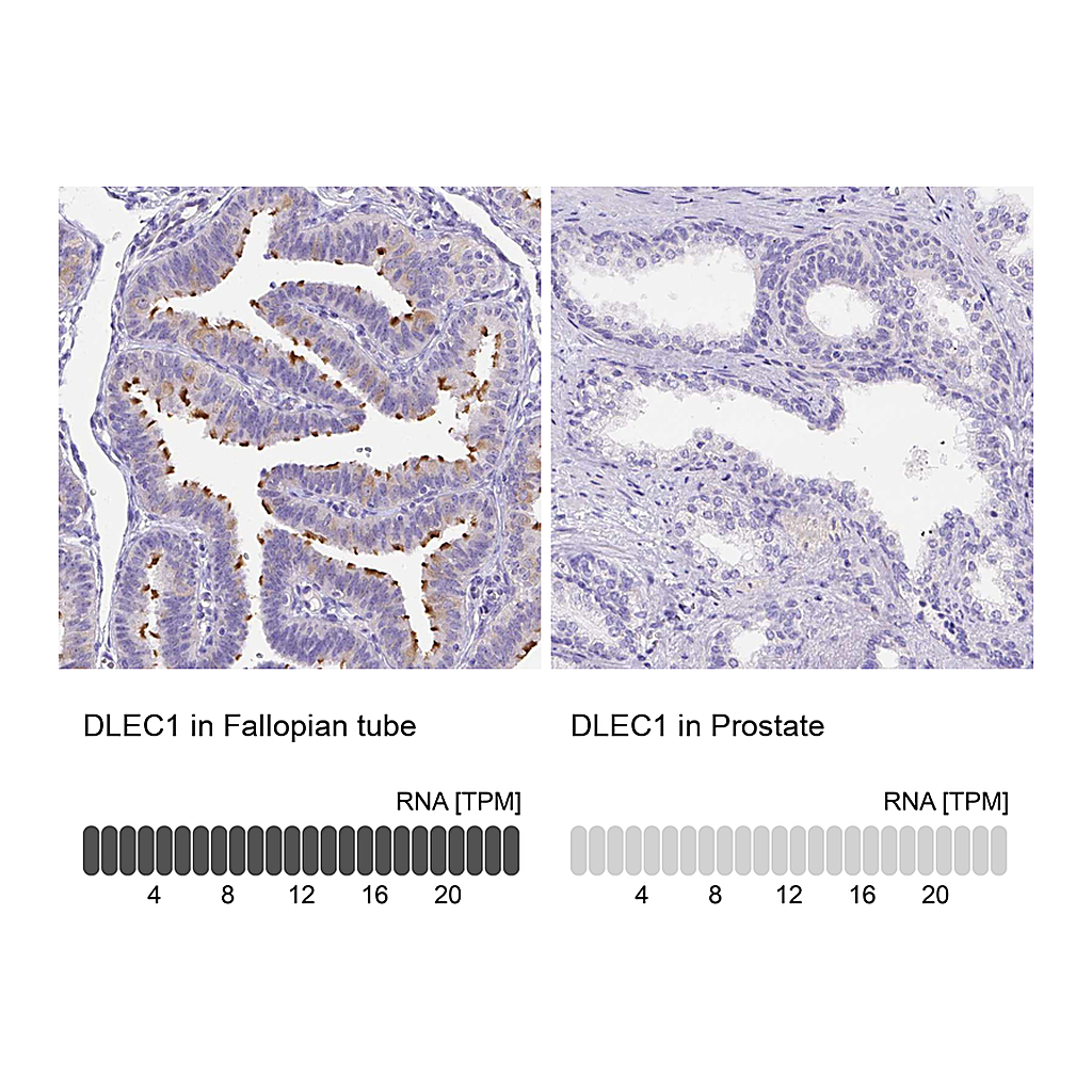 Atlas Antibodies Anti-DLEC1 Antibody