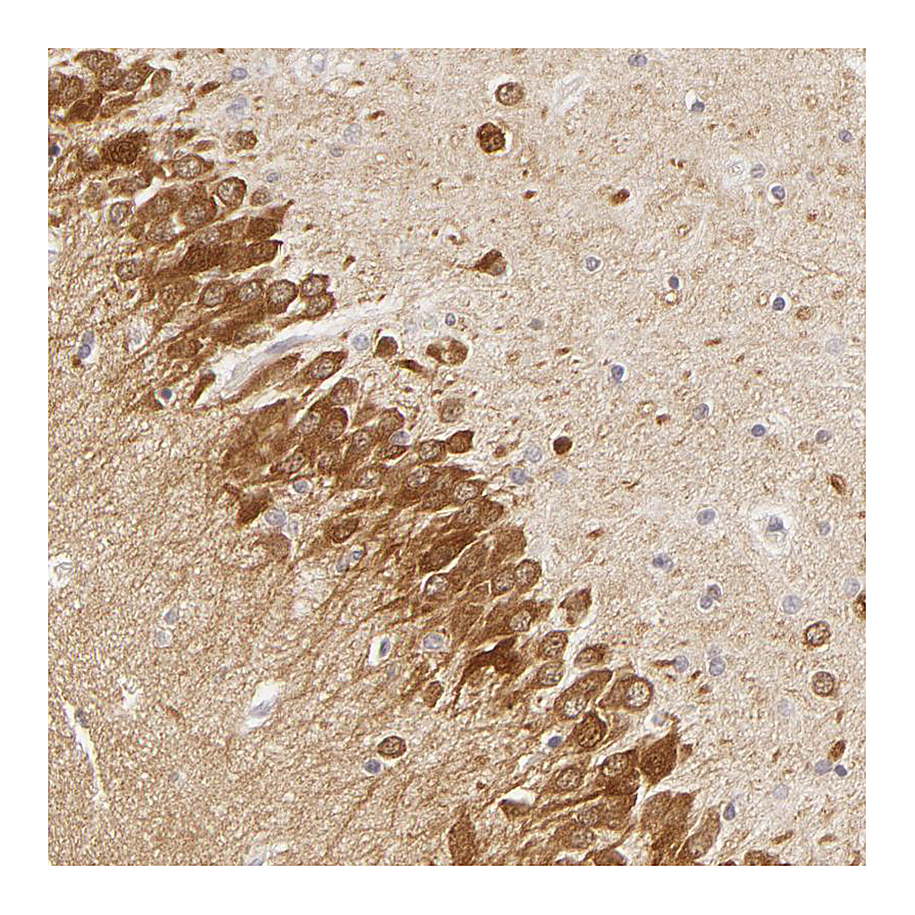 Atlas Antibodies Anti-DLG3 Antibody