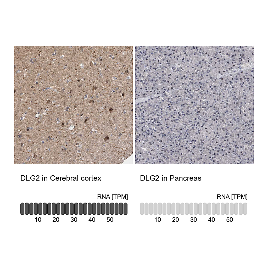 Atlas Antibodies Anti-DLG2 Antibody
