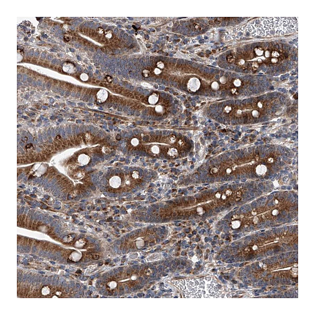 Atlas Antibodies Anti-DLGAP2 Antibody