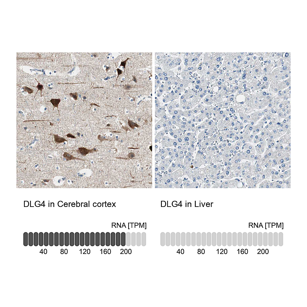 Atlas Antibodies Anti-DLG4 Antibody