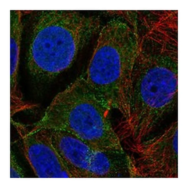 Atlas Antibodies Anti-DLGAP3 Antibody
