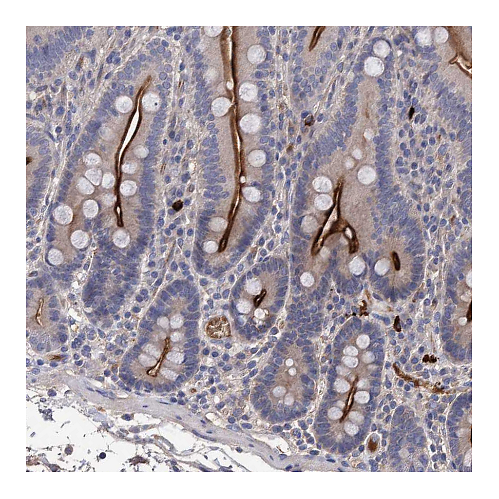 Atlas Antibodies Anti-DLL4 Antibody