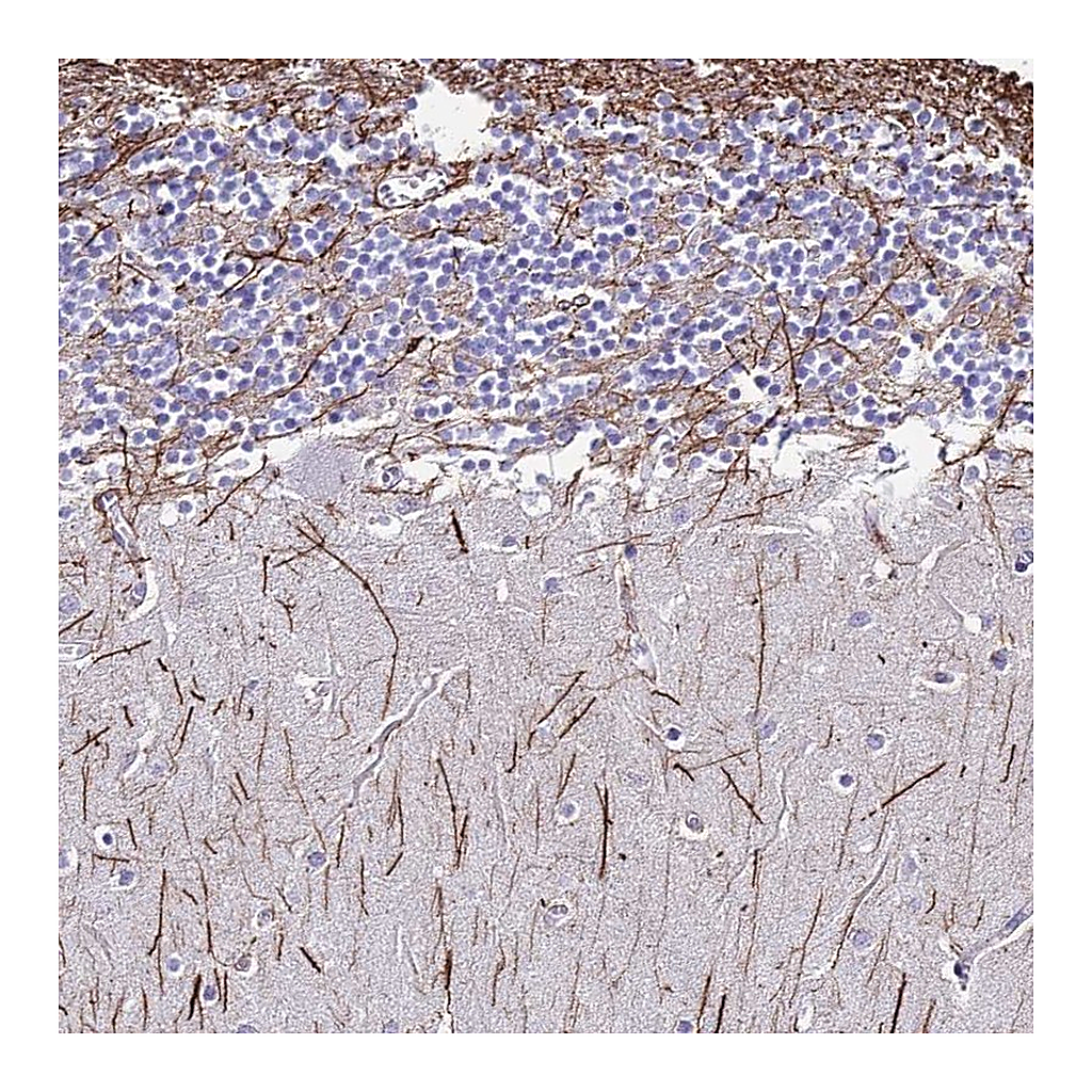 Atlas Antibodies Anti-DLX1 Antibody