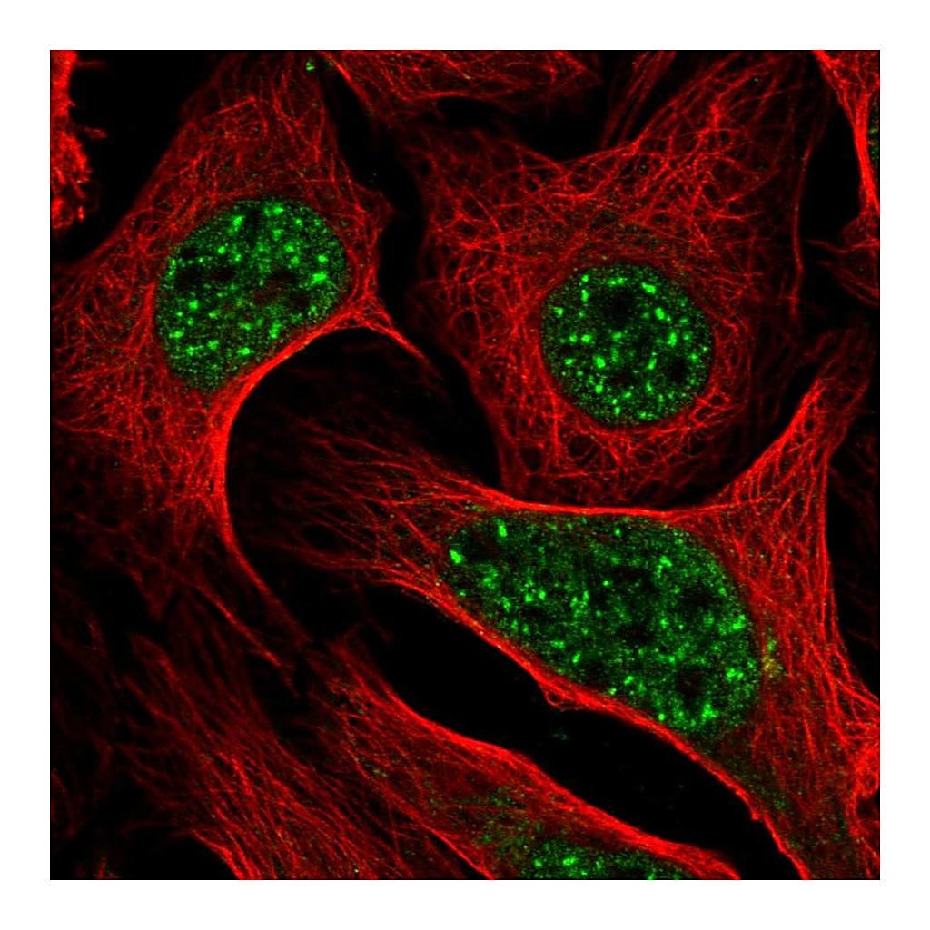 Atlas Antibodies Anti-DLX2 Antibody