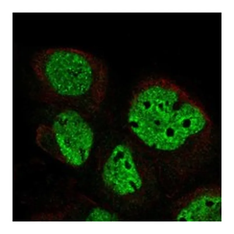 Atlas Antibodies Anti-DLK2 Antibody