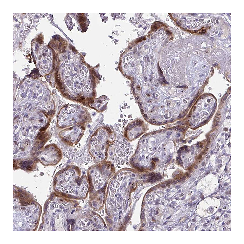 Atlas Antibodies Anti-DLX4 Antibody