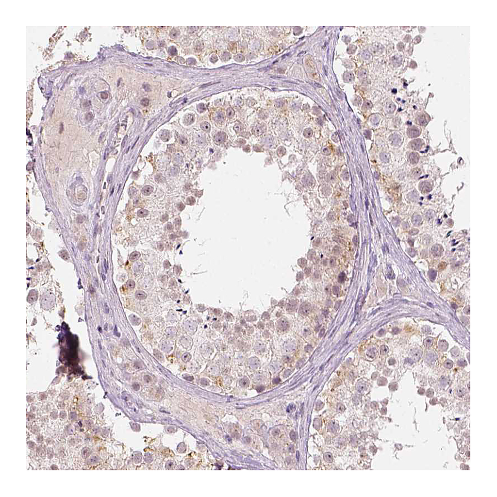 Atlas Antibodies Anti-DLX6 Antibody