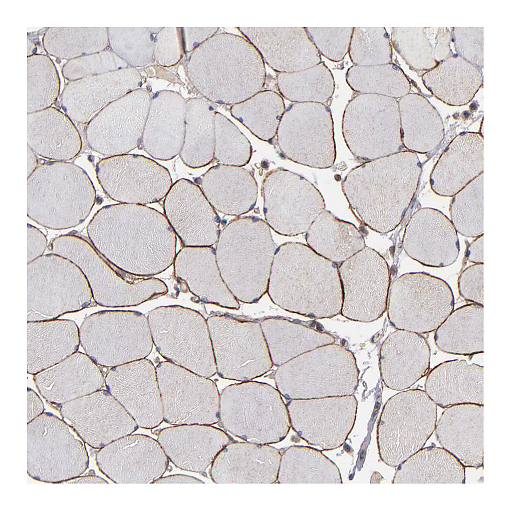 Atlas Antibodies Anti-DMD Antibody