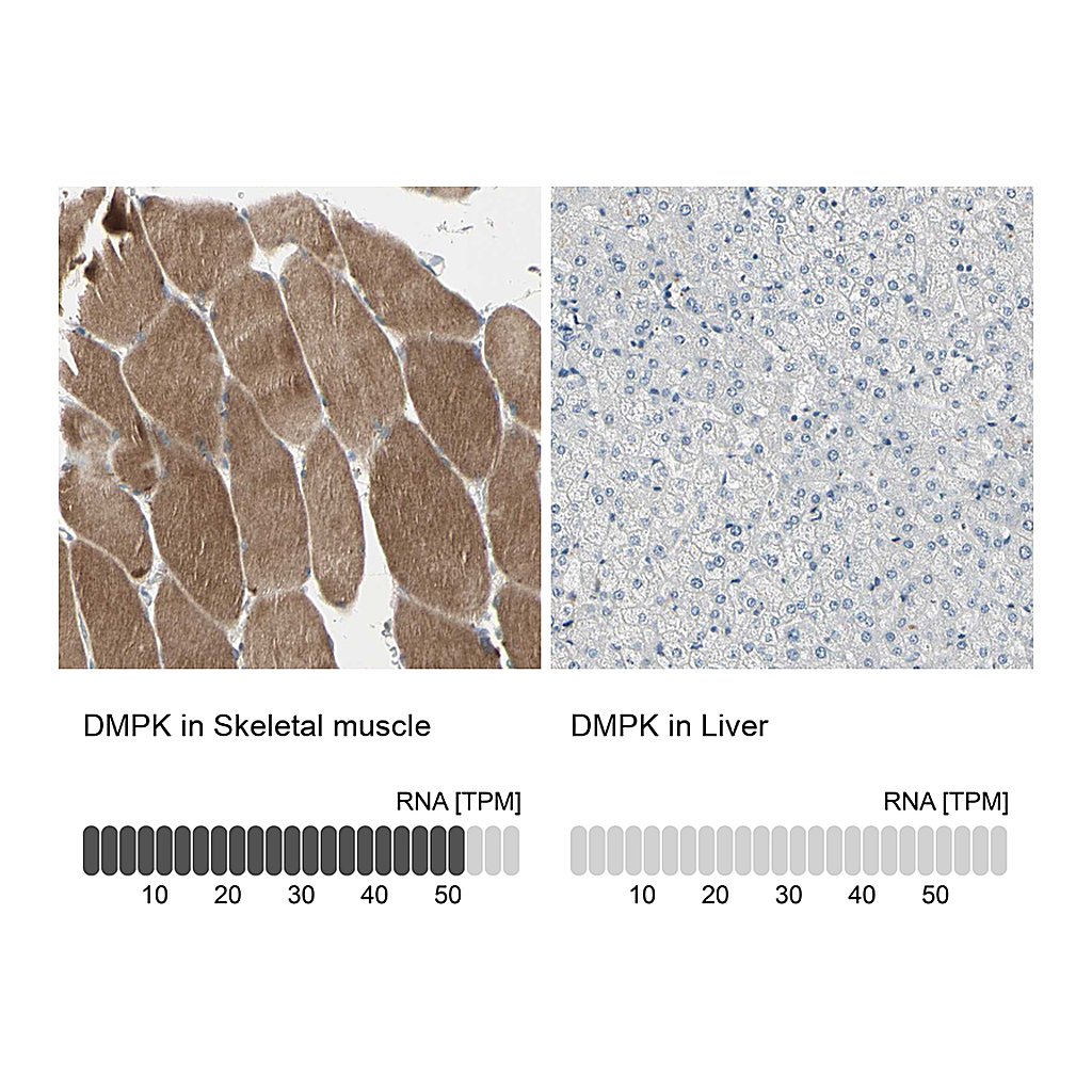 Atlas Antibodies Anti-DMPK Antibody