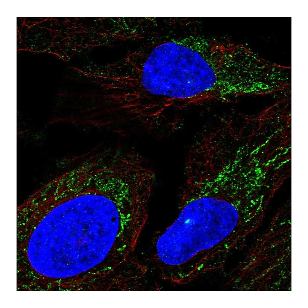Atlas Antibodies Anti-DMGDH Antibody