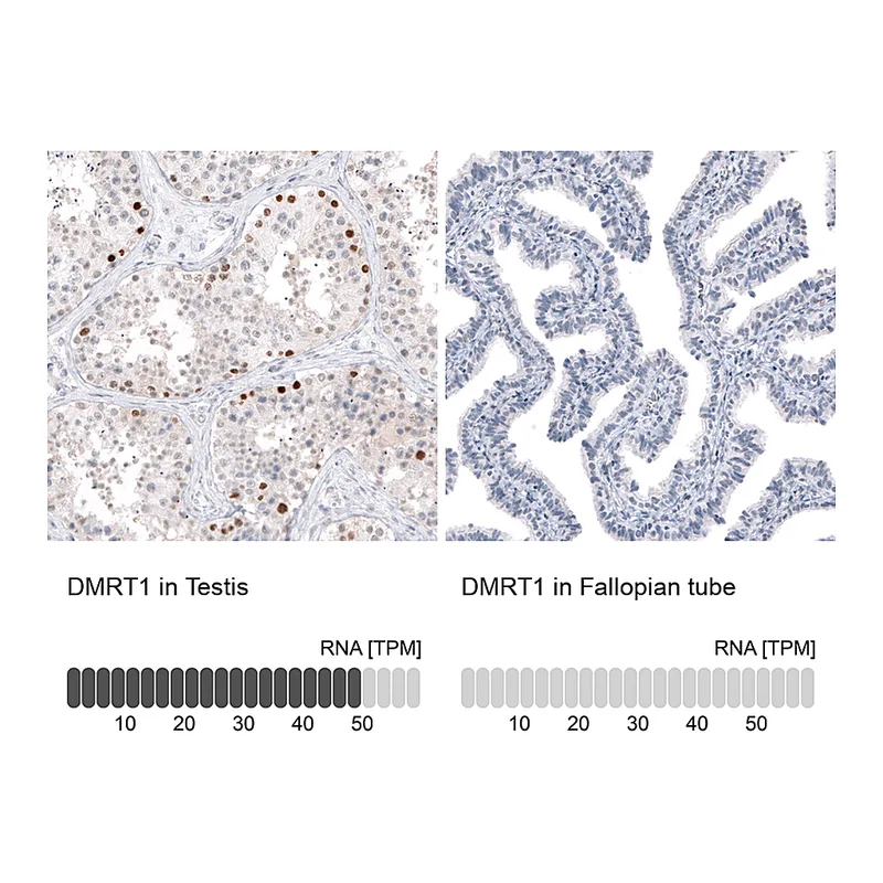 Atlas Antibodies Anti-DMRT1 Antibody